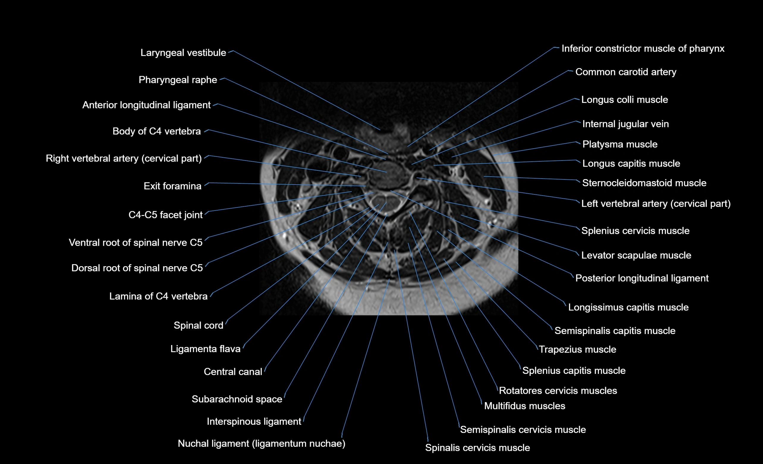 cervical spine cross sectional MRI anatomy  3T MRI axial  image-img-00001-00022.webp